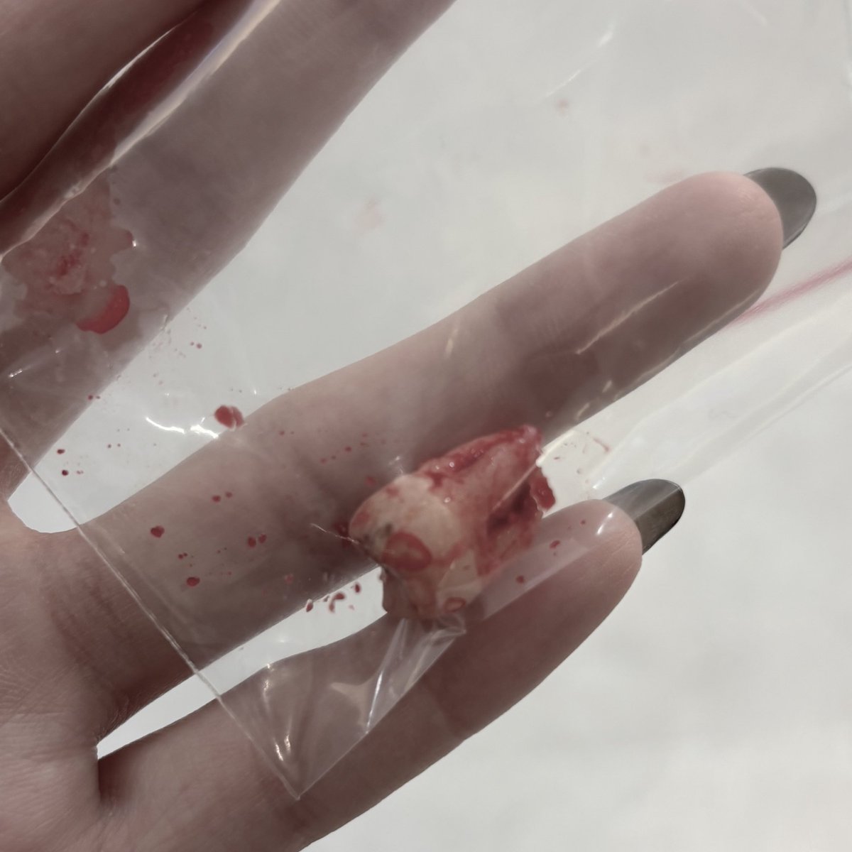 最後一顆智齒ㄌ-.-🦷

（蛀牙才拔掉ㄉ 不然我想讓他陪我進棺材） https://t.co/iphG77LHb9