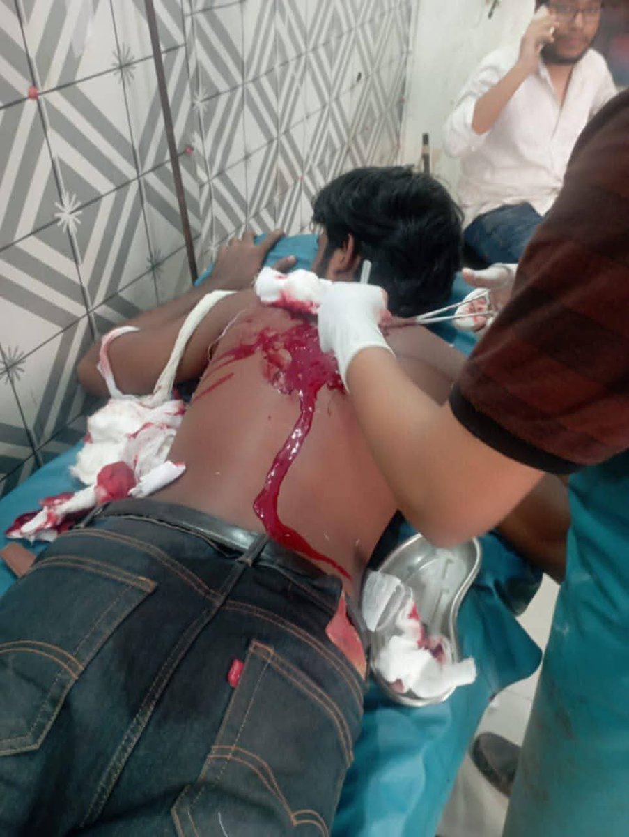 ক্যাম্পাসে রামদা নিয়ে ঢুকে ছাত্রদের মারতে আসে ছাত্রদল এর পোলাপান, একটু পর পর একজন কে মেডিকেল এ পাঠানো লাগতেছে, দুপুর আড়াইটার পর থেকেই এই অবস্থা, কোনো আর্মি কিংবা পুলিশ? নাই কেউ ই।