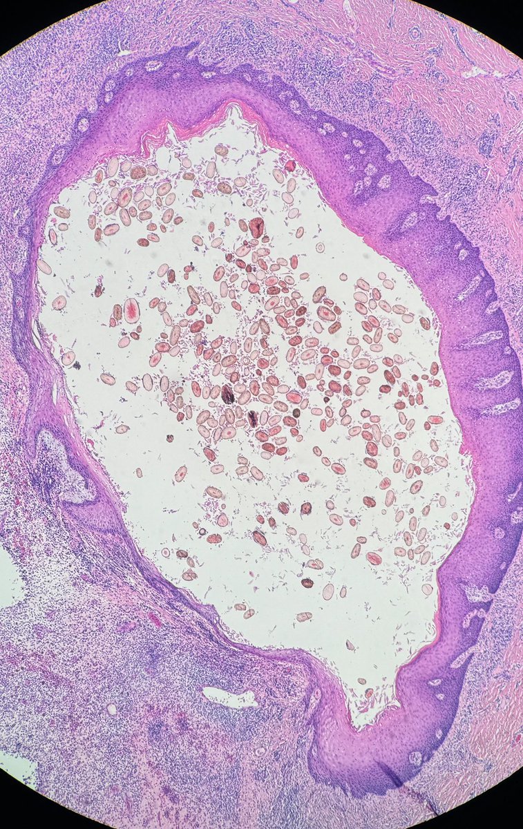 nerdyDP's tweet image. #Dermatology #dermpath #histology #pathology  Hair party