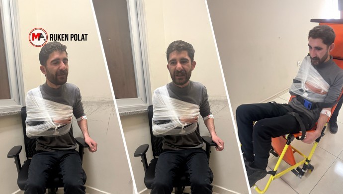 Van Emniyeti'nde işkence! 

Kayyım atamasına karşı protestolarda 55’i çocuk, 400’ün üzerinde kişi gözaltına alındı, 24’ü tutuklandı. Gözaltına alınanlarda kafa, kol ve elde kırıklar, vücutta ise ağır darp izleri tespit edildi. Serbest bırakılan 2 kişide kısmi görme kaybı oluştu.