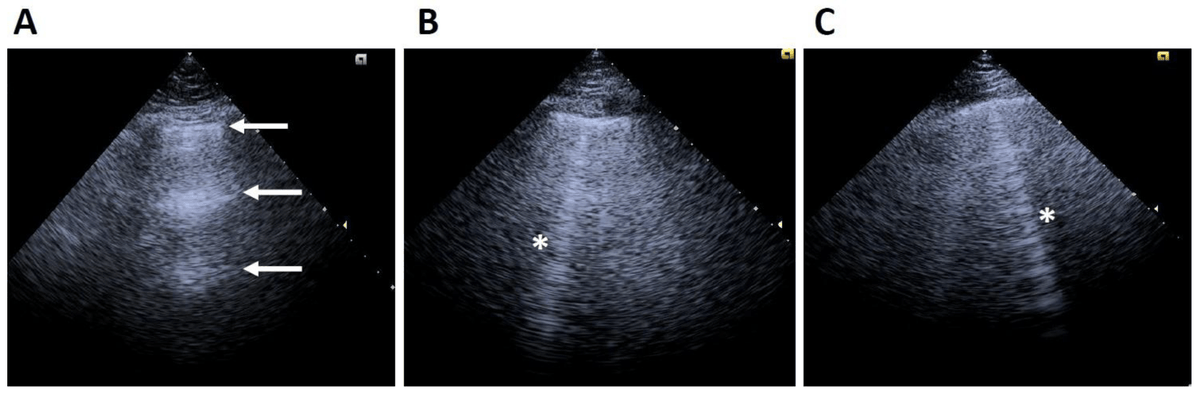 diagnostic_mdpi's tweet photo. #HighlyAccessed #DiagnosticsMDPI
"Point-of-Care Ultrasound in Nephrology: Beyond Kidney Ultrasound" by Victor Hugo Gómez-Johnson et al.
📄Read the full paper here: https://t.co/bb4LsIh8PN https://t.co/oaVtOEIUei