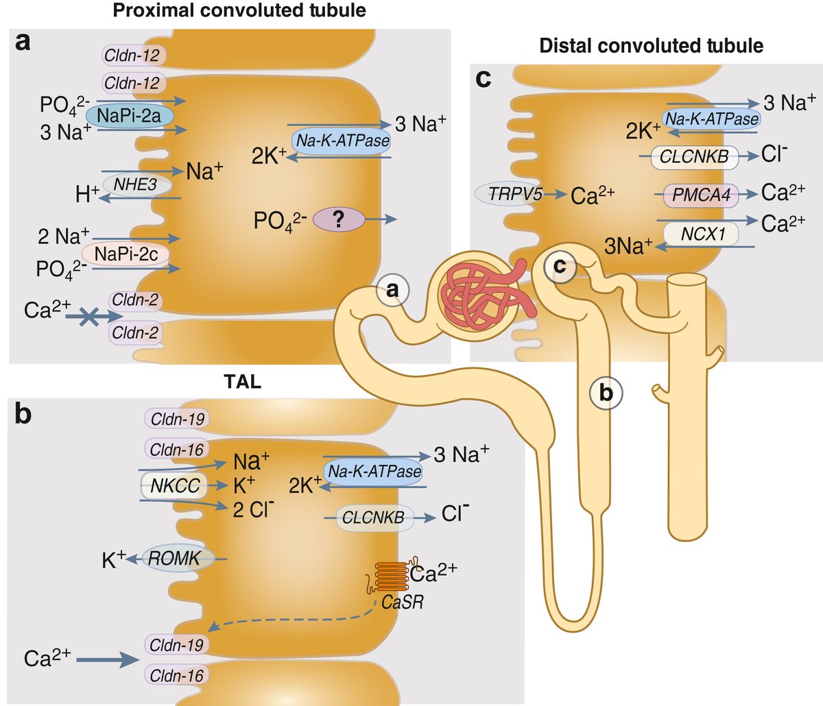 Kidney International (@kidney_int) on Twitter photo Shaking it off: loss of NHE3-mediated calcium reabsorption is compensated by the distal nephron
doi.org/10.1016/j.kintā¦
Original article: doi.org/10.1016/j.kintā¦
#KICommentary #medtwitter #nephtwitter
<a href="/UAlberta_FoMD/">UAlberta Med & Dent</a> Shaking it off: loss of NHE3-mediated calcium reabsorption is compensated by the distal nephron
doi.org/10.1016/j.kintā¦
Original article: doi.org/10.1016/j.kintā¦
#KICommentary #medtwitter #nephtwitter
<a href="/UAlberta_FoMD/">UAlberta Med & Dent</a>