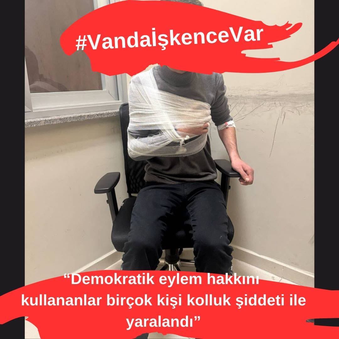 SAFYEAKDA's tweet photo. #VandaİşkenceVar https://t.co/ADnUFVLbEp
