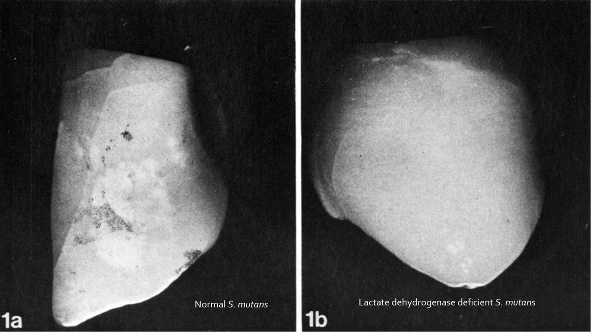 cremieuxrecueil's tweet image. The cavity vaccine is finally shipping out to customers.

It's very likely that if people use this to replace the Streptococcus mutans in their mouth with this variety that puts out alcohol instead of lactic acid, cavities will become far less common.