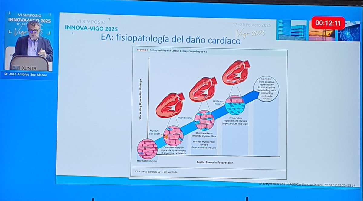 INNOVA VIGO 2025 en directo🔥, Hemodinámica y Cardiologia🔝 Intervencionista, inscribete 👇
med-home-es.zoom.us/webinar/regist…