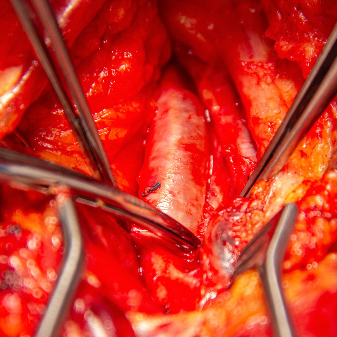 CAMC Vascular Surgery Residency and Fellowship tweet media