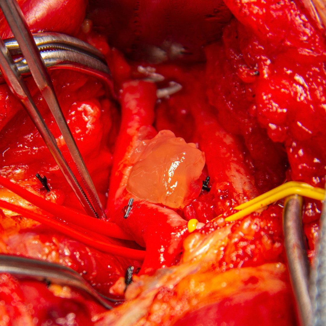 CAMC Vascular Surgery Residency and Fellowship tweet media