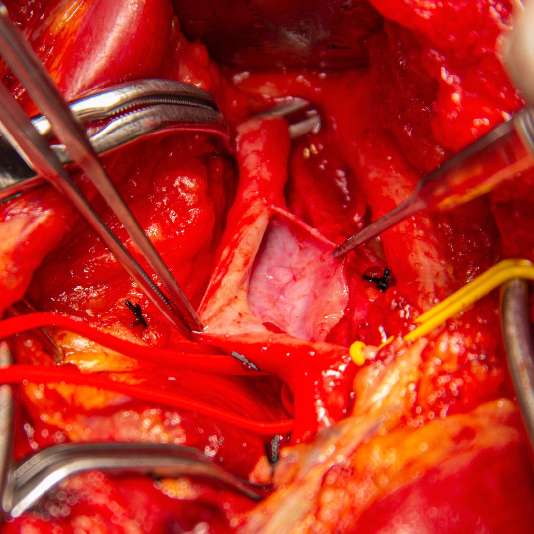 CAMC Vascular Surgery Residency and Fellowship tweet media