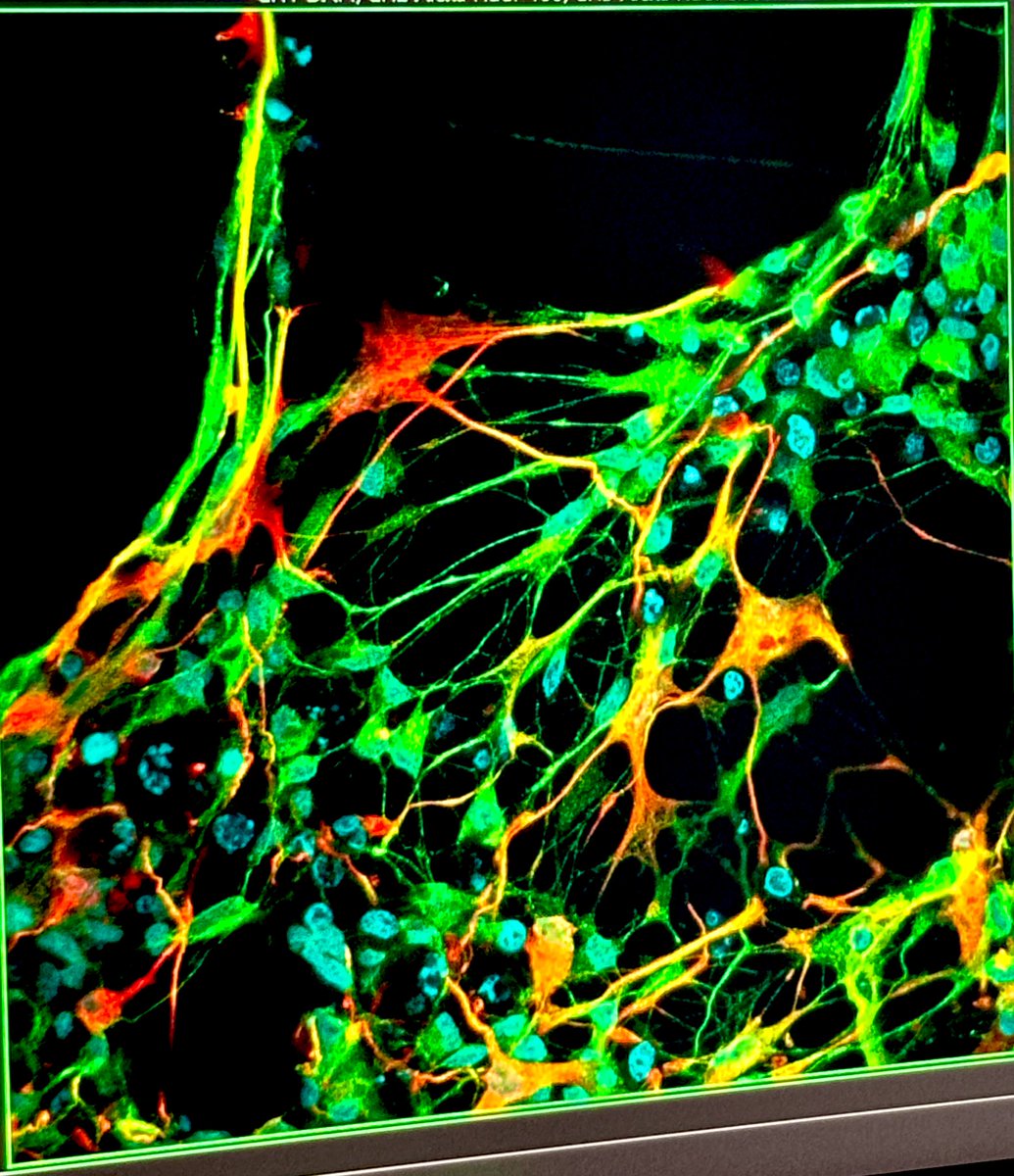 MAYURI221122's tweet photo. Neurons+astrocytes✨✨✨🥹🥹
#confocal 
#microscopy https://t.co/8zV7w858Sz