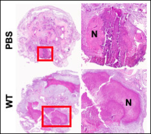 In a chick chorioallantoic membrane tumor model, Salmonella preferentially colonized tumors, causing tumor cell death. The growth defects of attenuated strain VNP20009 reduced tumor colonization &amp; explains why the clinical trial failed. <a href="/kenneylj/">Linda Kenney</a> #mBio doi.org/10.1128/mbio.0…