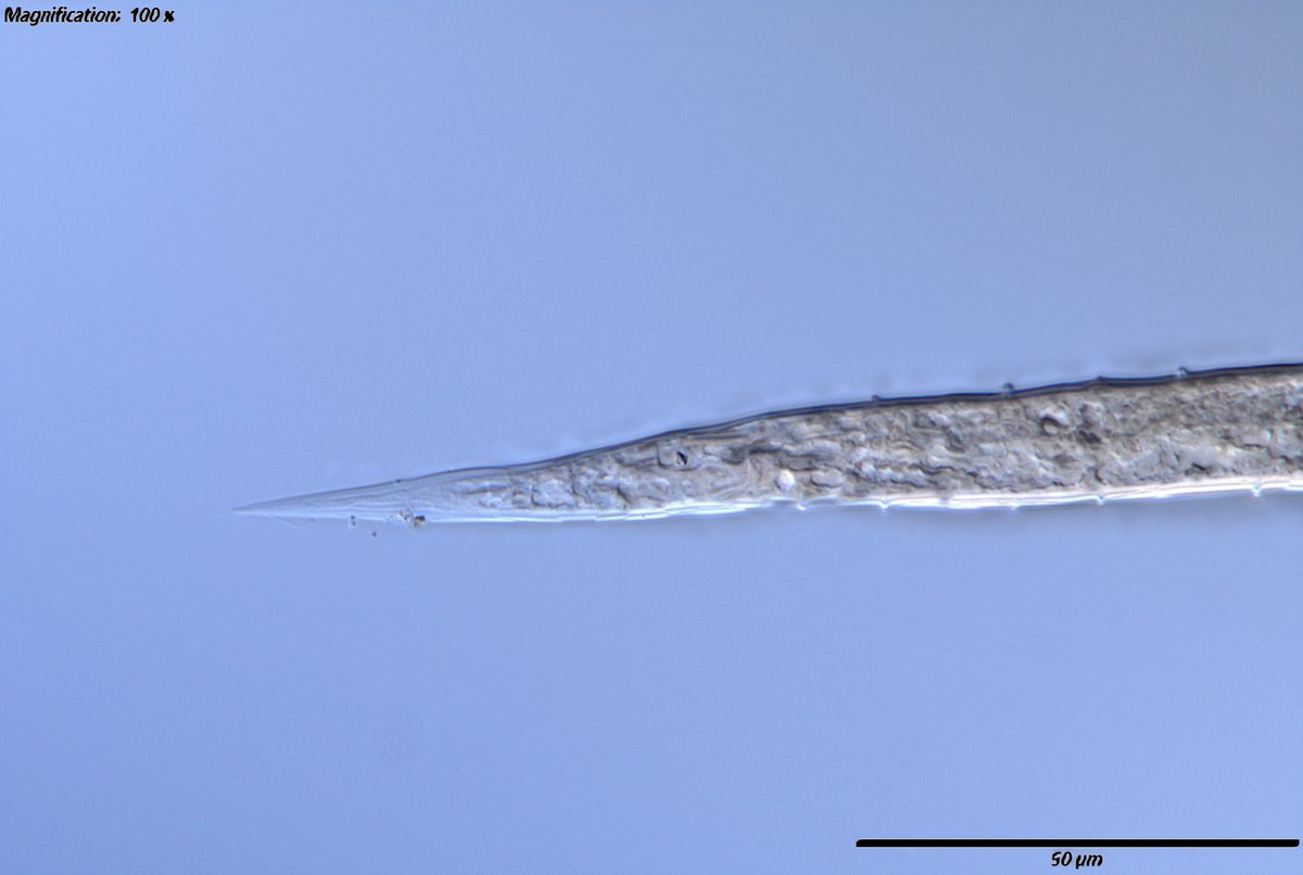 An unusual growth on a nematode's cuticle. The nematode's morphology is, unfortunately, not well defined.