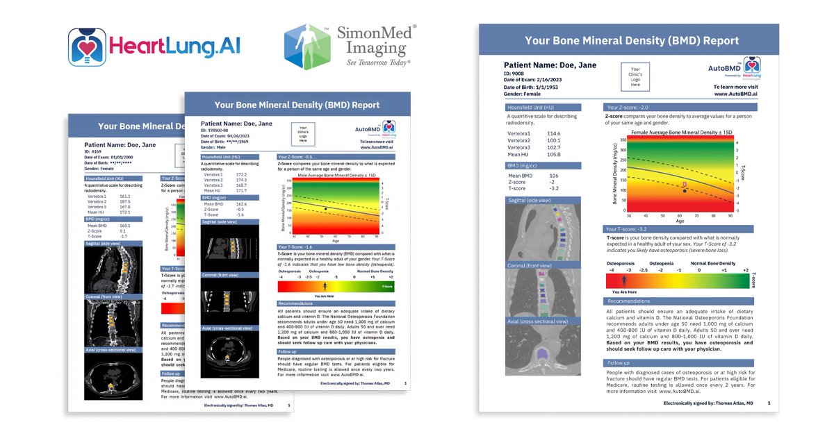 🚨⚕️ SimonMed Imaging, the largest physician-owned outpatient imaging center in the US, partners with HeartLung.AI to offer Artificial Intelligence-Based Osteoporosis Screening (AutoBMD™ AI) as an add-on to CT Scans Nationwide.

This partnership is a major step