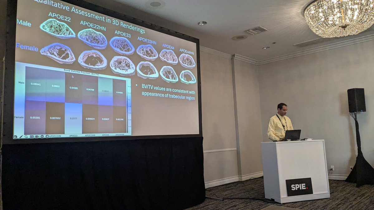 A great presentation today by Rohan Nadkarni, our #Duke #QIAL group member on #PhotonCountingCT for bone imaging in APOE mouse models—showcasing how advanced  imaging provides deeper understanding of bone and its connection to  genotypes, sex, and immune system.