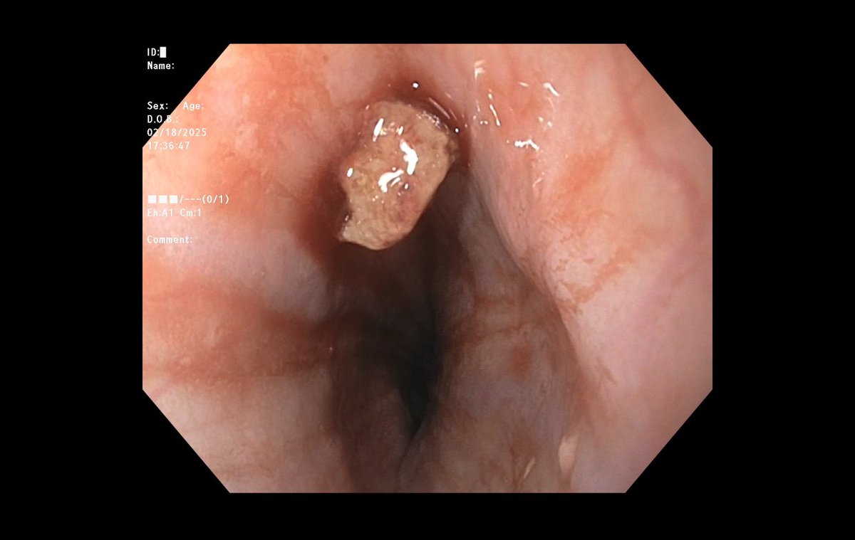 Fady Banno, MD tweet media