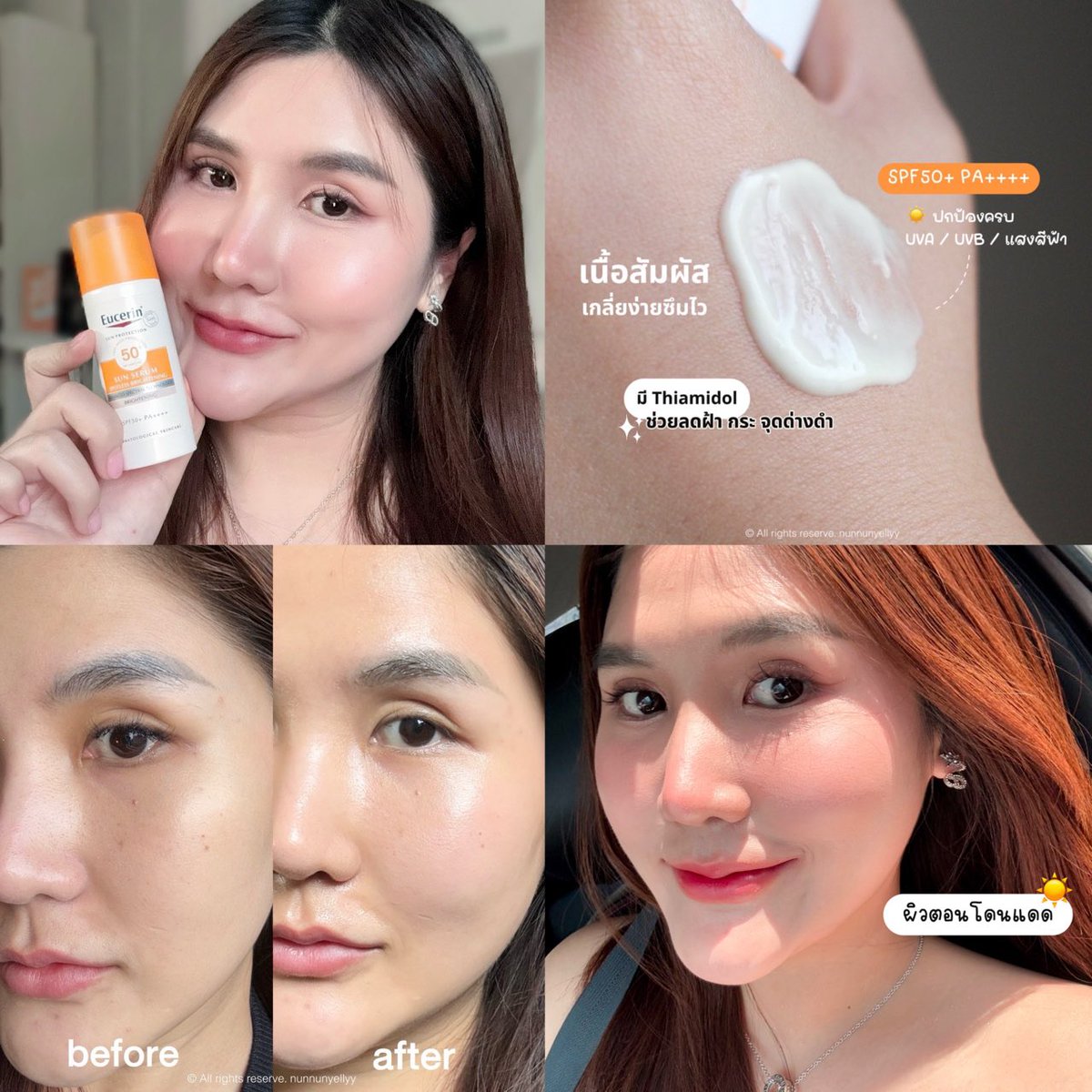 จากใจคนใช้ Eucerin เป็นประจำ ฝ้ากระแดดที่เคยเป็นตั้งแต่ช่วงหัดว่ายน้ำสมัยเรียน คือจางลงไปดีมาก กว่าจะรักษาฝ้ากระแดดได้ไม่ใช่เรื่องง่ายอะ ทุกวันนี้กันแดดคือรูทีนที่จะขาดไม่ได้  สูตรที่ใช้ประจำก็ ยูเซอริน ซัน สปอตเลส ไบรท์เทนนิ่ง หรือกันแดดไทอามิดอลแถบชมพู ตัวนี้เป็นกันแดดที่มีประสิทธิภาพมากๆๆ มี SPF 50+ PA++++ ปกป้องสูงครบทุกรังสี UVA UVB และครอบคลุมถึง แสงสีฟ้า ที่ทำร้ายผิวได้ลึกกว่า UV อีก เพราะมี AOX ประสิทธิภาพสูง และสาร ไทอามิดอล สารไบรท์เทนนิ่งที่ดีที่สุดจากยูเซอรินที่ช่วยป้องกันฝ้า กระ จุดด่างดำ ได้จริง!!!

⚡️ ทุกวันนี้แนะนำทุกคนที่ถาม ถ้าอยากผิวดี ก็ควรห้ามลืมที่จะทากันแดดอะ มันช่วยได้มากกกกก แอบแปะรูปประกอบให้ดู ถึงนุ่นจะไม่ได้เป็นหนัก แต่ที่เห็นได้ชัดเลยนอกจากจุดด่างดำคือ ไบรท์ขึ้นมาก ซึ่งถ้าเราไม่ดูแลรักษาพวกฝ้ากระแดดก็จะลุกลามไปไกล และกว่าจะถึงตอนนั้นคงยากที่จะหายขาดค่า แต่ผลลัพธ์ก็ขึ้นอยู่กับแต่ล่ะบุคคลน้า ยังไงดูแลดีๆแต่แรกดีกว่า จะได้ไม่ต้องเสียเงินไปรักษาทั้งที่ไม่รู้ว่าจะหายหรือไม่หายอีกด้วยย 

ใครมีปัญหาฝ้ากระแดดอย่าละเลยนะ 
มันลามได้นะทุกคนนน

#EucerinThailand #EucerinSunSpotless #ป้ายยาสกินแคร์ #รีวิวสกินแคร์  #ครีมกันแดด