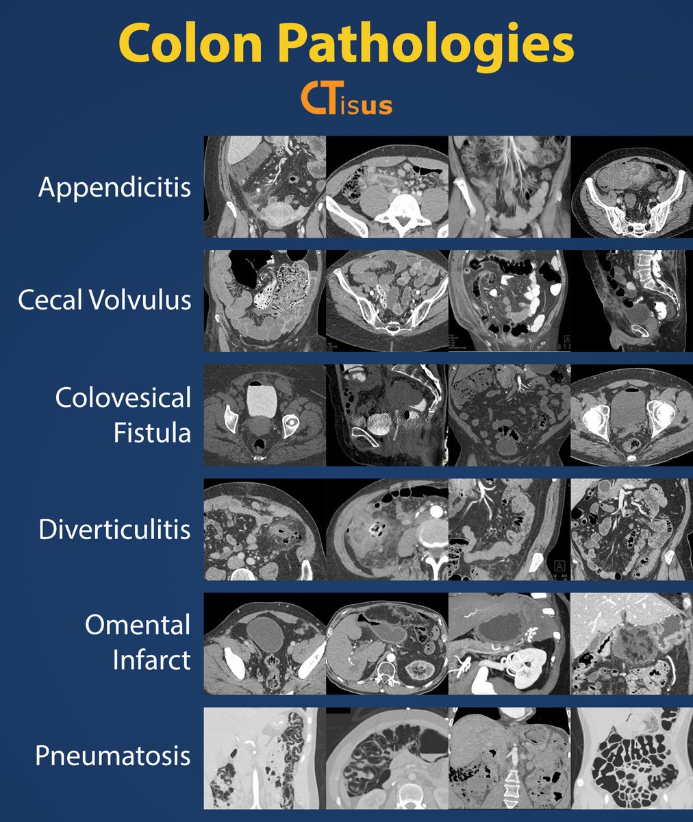 د زكريا الصفران (@doctorsafranzak) on Twitter photo 