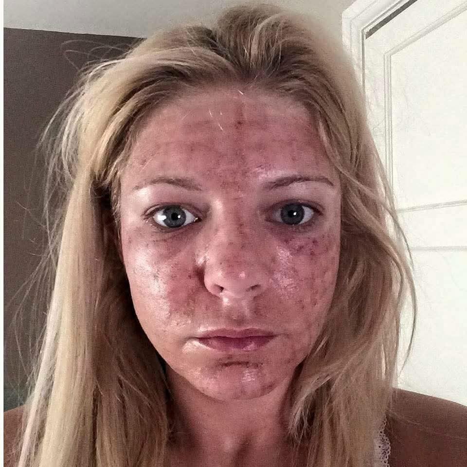 Because her face burn in fire 🔥and looking ugly 😱therefore, Every body ashamed of her 😭 If you're not ashamed hit a #Like and Type #AMEN ☝️