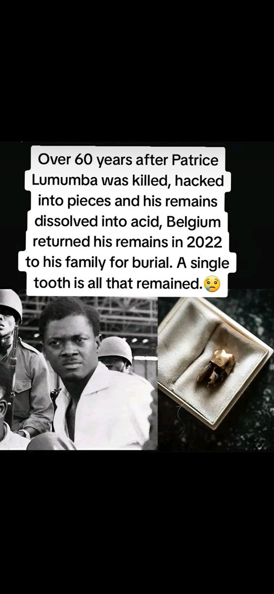 ubumanzi's tweet photo. @prevotmaxime May be you think we are the same idiots you dealt with 50 years ago.
May you think you can have us chopped into pieces and keep our teeth for exhibition like you did with Lumumba. 
We are not the Africa of 50 years ago, and you are not the Belgium 🔻of 50 years ago either. https://t.co/kCnkdGz6vk