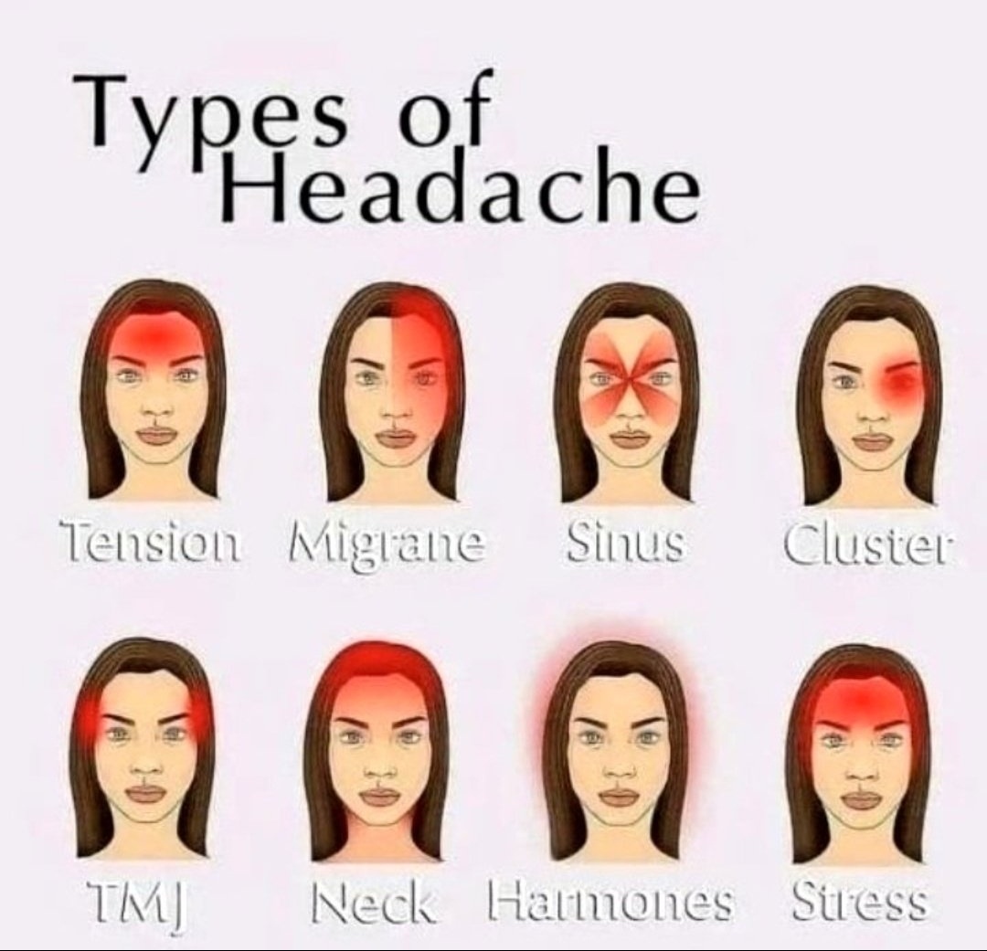 Types of Headache.