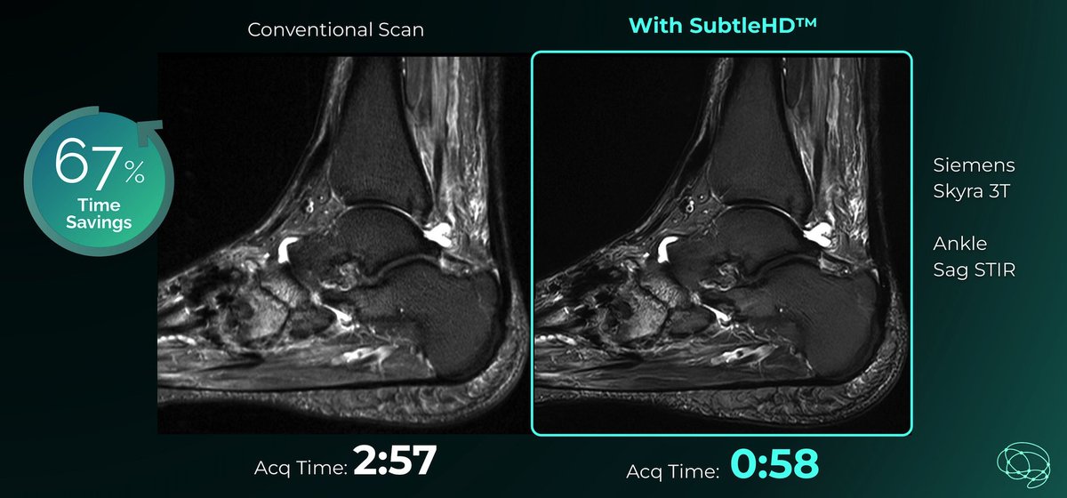 AppliedRadiology (@applied_rad) on Twitter photo Subtle Medical Nets FDA Clearance for AI-Powered MRI Acceleration and Enhancement Software
🔗 bit.ly/41mU4qT
#RadNews #Radiology #AI Subtle Medical Nets FDA Clearance for AI-Powered MRI Acceleration and Enhancement Software
🔗 bit.ly/41mU4qT
#RadNews #Radiology #AI