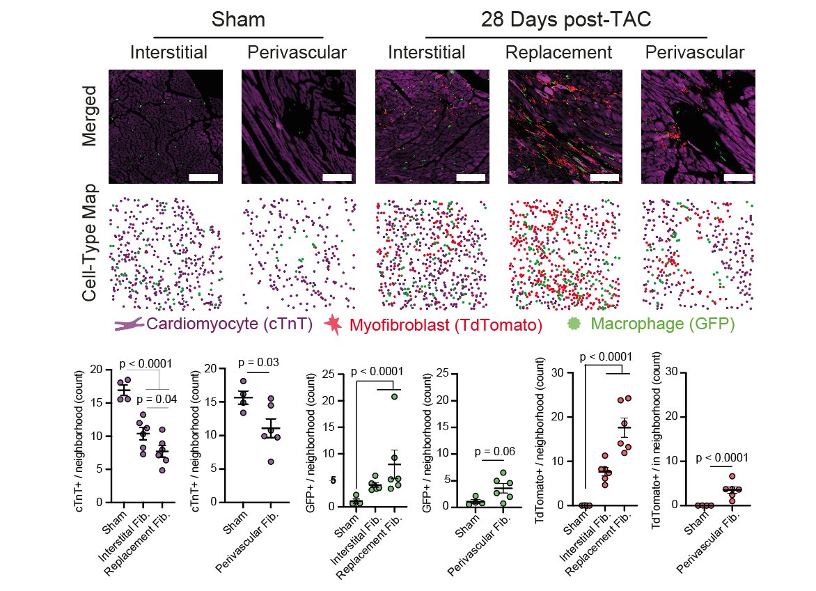 28 days following chronic pressure overload (TAC) MAMY mice hearts showed increased macrophage-myofibroblast numbers- depending on the fibrotic degree. We conclude that chronic cardiac damage leads to 🔥hot fibrosis.