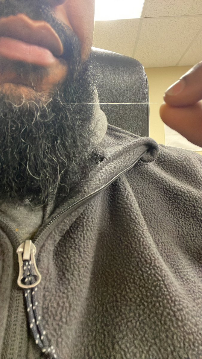 I got this one, well a few but this long ass gray hair just sticks out! 

Maybe cause I tug on the shit