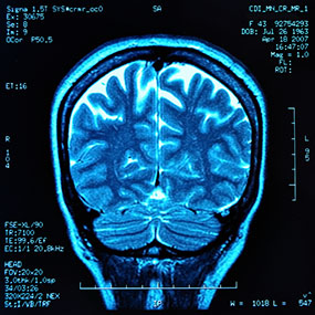 Jefersonnasa_'s tweet image. El TDAH no es un trastorno.

Es una diferencia en la cognición.

Es necesario aprovecharlo, no sedarlo con pastillas. Una vez que lo hagas, te volverá hiperconcentrado.

Esto es lo que puedes hacer para convertir el TDAH en un superpoder...