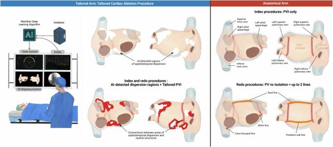 EntrepreneursAI's tweet photo. AI doesn't just predict disease; it treats it with guided ablation for AFib. #AIFib #Cardiology #Issue36
https://t.co/wWDRd59CfG https://t.co/3bsEdJLUGH