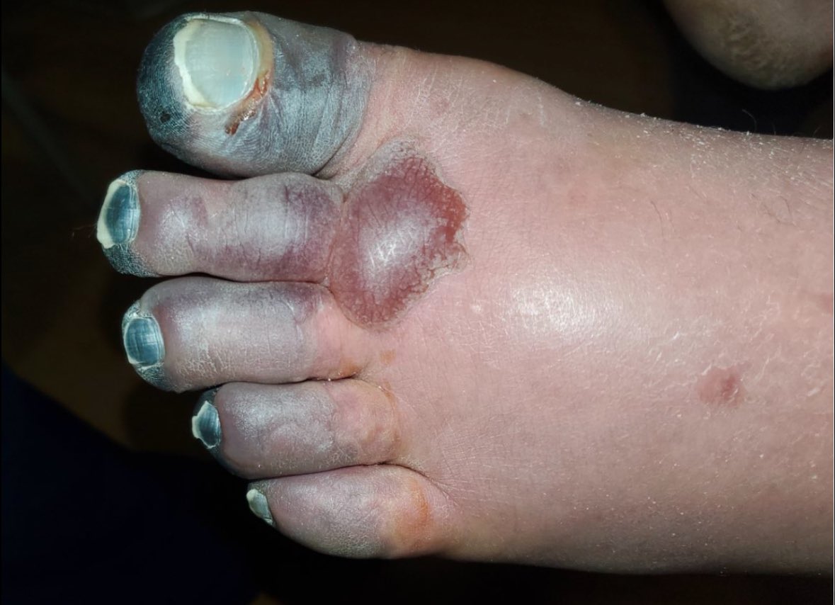 Barstool Jays (11-0) (@barstool_seward) on Twitter photo Let go <a href="/SewardBlueJays/">SewardBlueJays</a> let’s do the right thing tonight and not let anyone else get this like my buddy did walking his ass to school. Let go <a href="/SewardBlueJays/">SewardBlueJays</a> let’s do the right thing tonight and not let anyone else get this like my buddy did walking his ass to school.