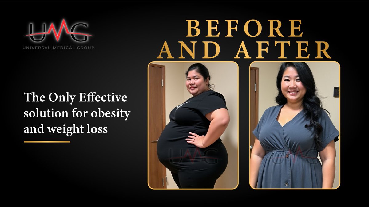 UMGSanDiego's tweet image. What will your transformation look like in 2025?
This is a real example of what bariatric surgery can achieve! Let UMG help you transform not just your body, but your life. Schedule your consultation now before February 20th!
🔗 universalmedicalgroup.com/book-your-surg…
#TransformationSuccess