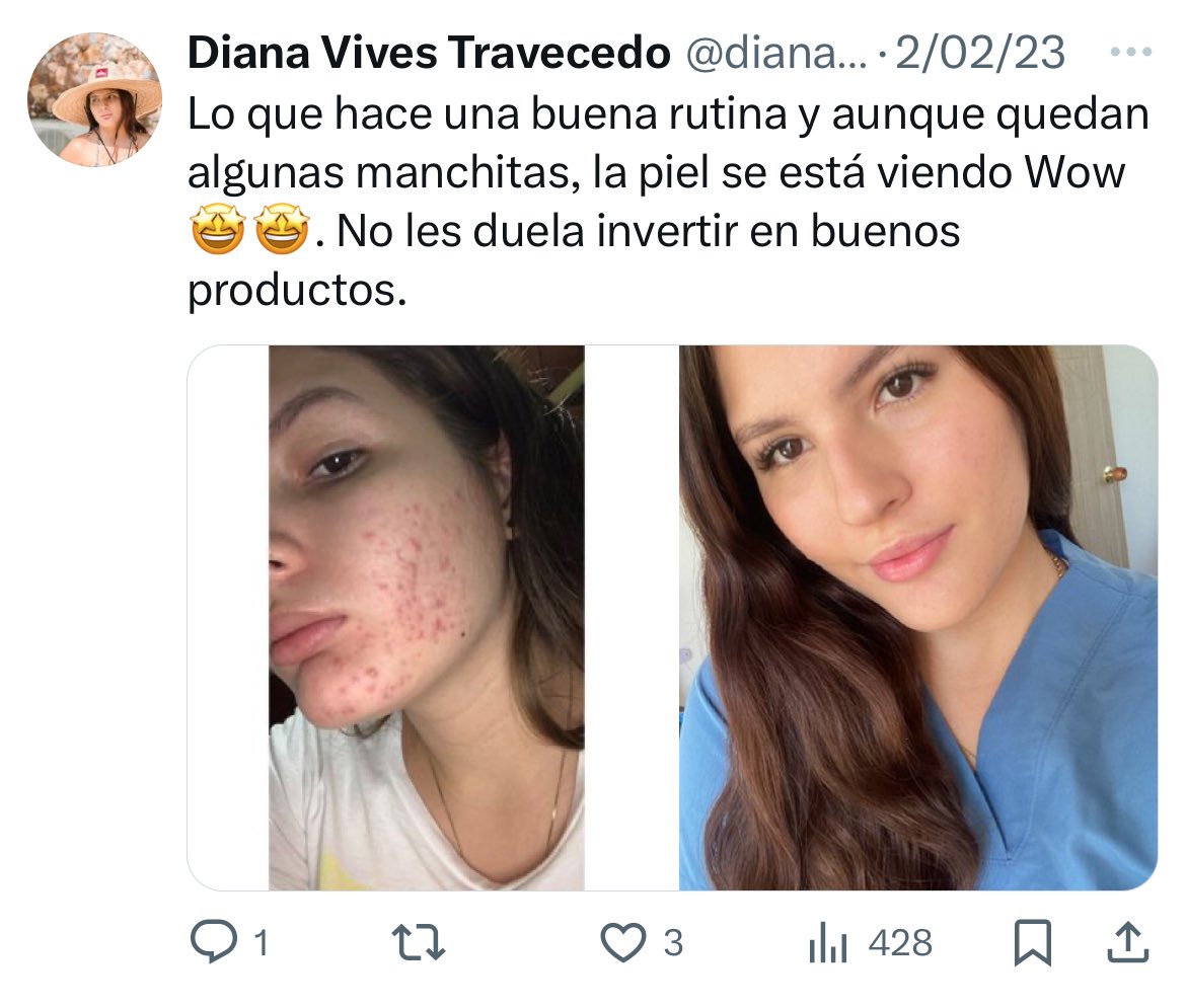 dianamvives's tweet photo. El 2/02/2023 hice esta publicación por lo de lo feliz que estaba con mi proceso, hoy después de mucho tiempo 😫😫 comenzando desde 0. https://t.co/JGIYK5DKGN