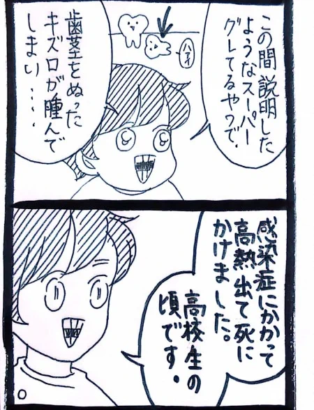 親知らずといえば、これは私が親知らずぬいた話です。
抜く前の準備、フォロワーさんからたくさん知識をもらいました。 