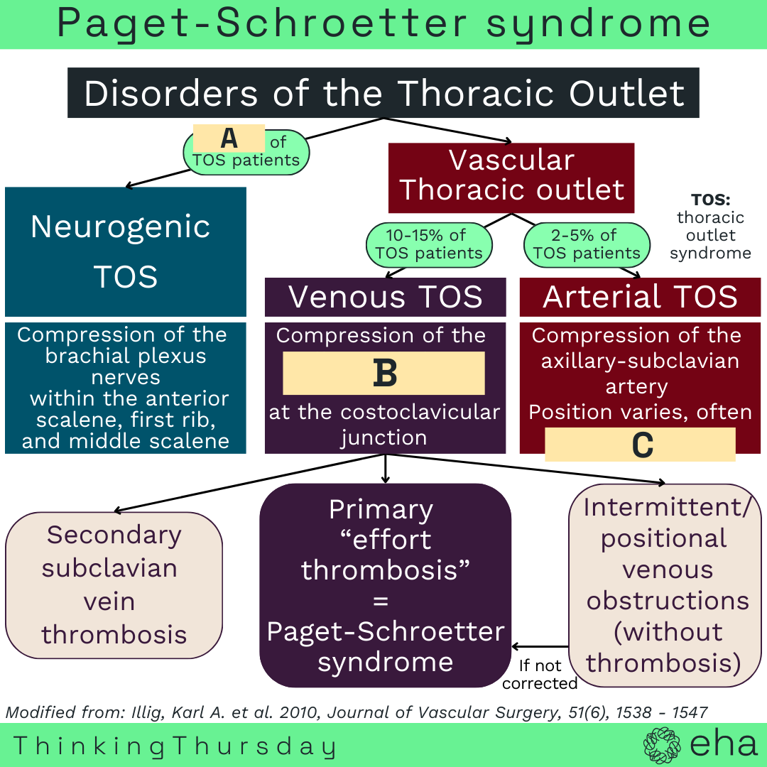 EHA_Hematology's tweet photo. Today’s EHA #ThinkingThursday was submitted by Dr. Ruxandra Irimia from @YoungEHA and focuses on effort #thrombosis. This is a rare disease from the thoracic outlet also known as #Paget-Schroetter syndrome #rarediseaseday. Can you fill in A, B and C? Share your answers in the comments below or swipe for the answer.

What did you think of this microlearning experience? Help EHA by filling this one-minute survey: https://t.co/S6IR7ZoJFg