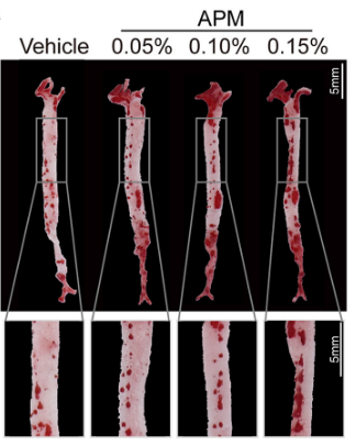 Aspartam (suni tatlandırıcı) kullanımı, gereksiz  fazla insulin salınımı yoluyla damar sertliğini hızlandırmaktadır.

En solda kontrol, diğer üçü farklı dozlarda aspartam kullanımının  yaptığı damar sertliği göstergesi plaklar.
cell.com/cell-metabolis…