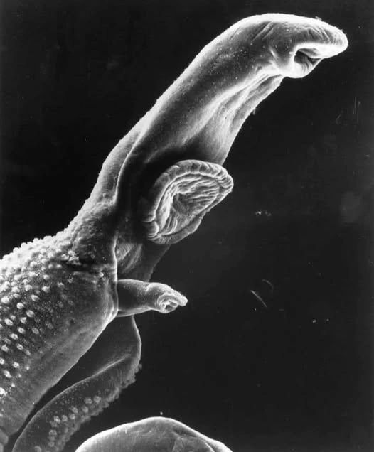 888 KREBS IST EIN PARASIT 

Ein neues Protokoll zur Krebsbehandlung ist eingetroffen, das die milliardenschwere Krebsindustrie zerstören soll.

Das Protokoll bestätigt, dass die wahre Natur des Krebses ein Parasit ist, daher ist Ivermectin in Kombination mit Mebendazol und