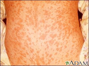 Neil Stone tweet media