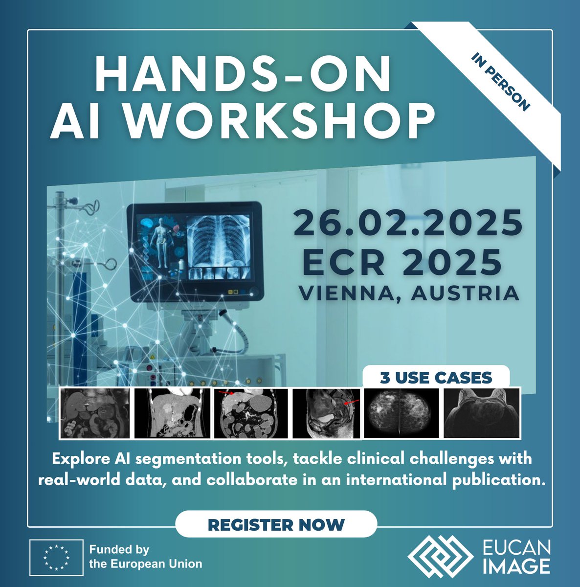 Radio Val (@radioval_ai) on Twitter photo 🚨 Calling all #Radiologists! 🚨
🔍 Join <a href="/EuCanImage/">EuCanImage</a> hands-on workshop at #ECR2025 and get involved in a one-of-a-kind in silico trial!
®️ Secure your spot today: eucanimage.eu/eucanimage-wor…
#HorizonEU #EUfunded #Radiology 🚨 Calling all #Radiologists! 🚨
🔍 Join <a href="/EuCanImage/">EuCanImage</a> hands-on workshop at #ECR2025 and get involved in a one-of-a-kind in silico trial!
®️ Secure your spot today: eucanimage.eu/eucanimage-wor…
#HorizonEU #EUfunded #Radiology