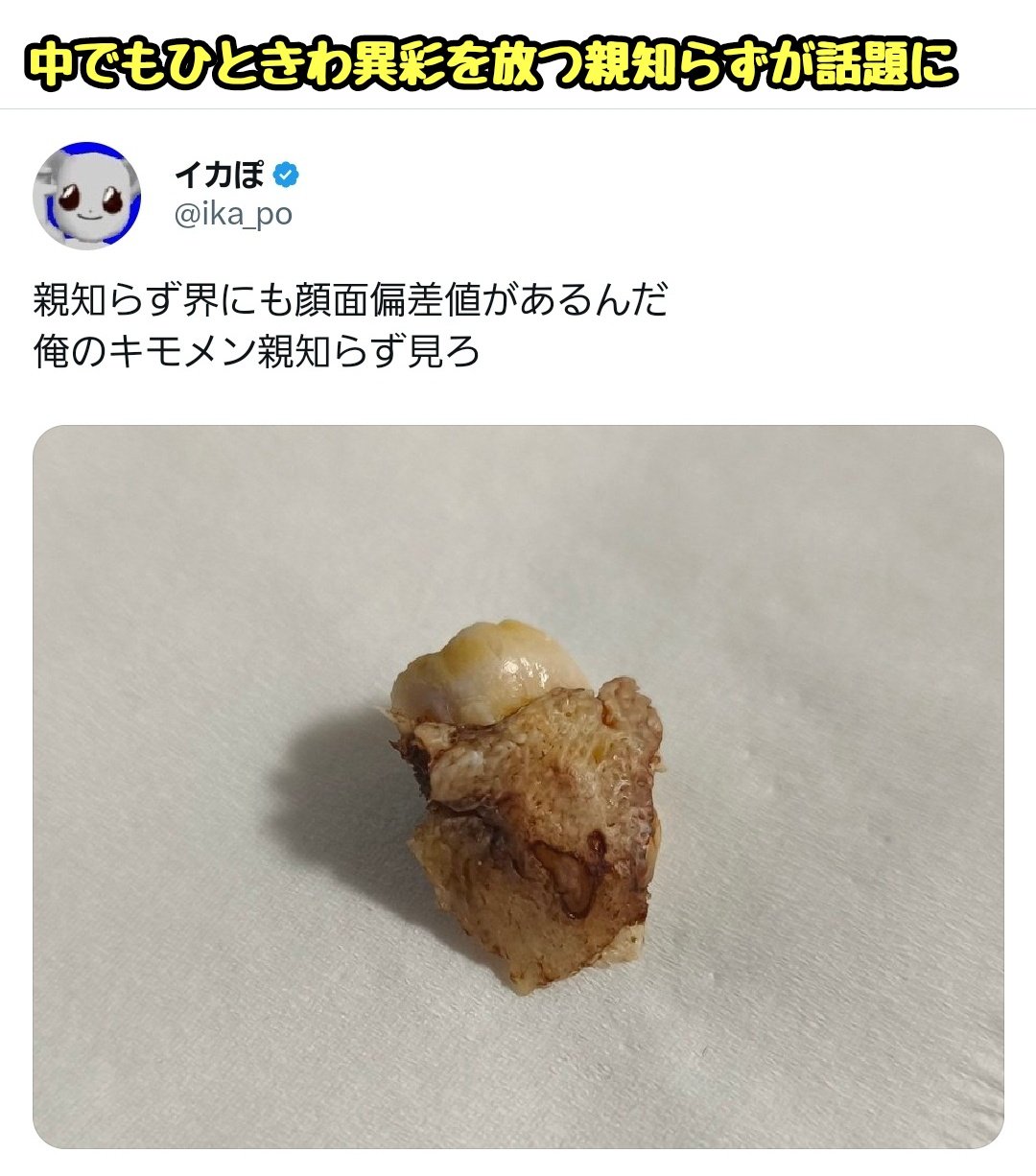 キモメン 歯医者に「こんなカワイイの初めて」と言われた“親知らず”の写真が話題に ↓ Ｘ民による親知らず自慢大会が勃発 ↓  みんながカワいい親知らず画像をシェアするなか、ひときわ異彩を放つ“キモメン”親知らずが投稿される ↓ なんかキモい上に、ずっと見 ...