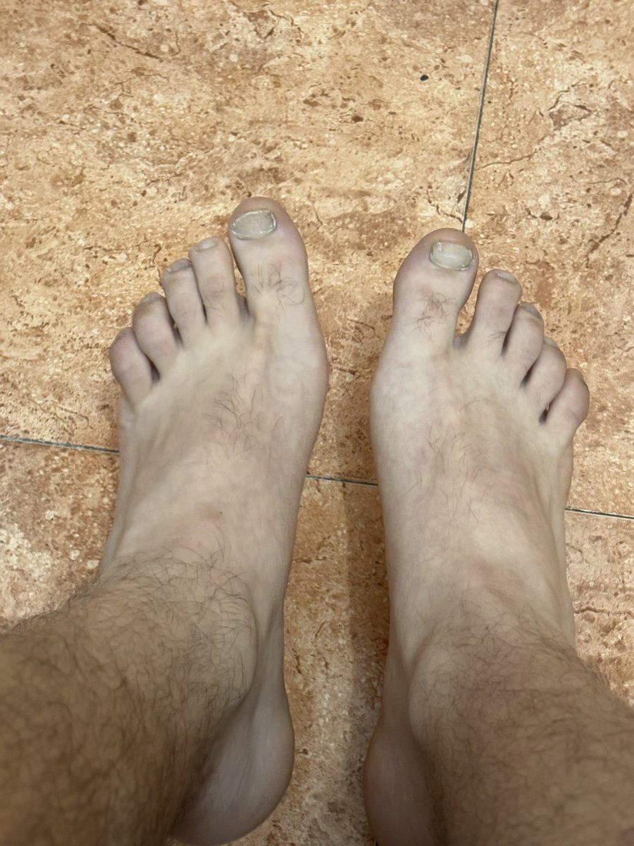 arabmaster04's tweet photo. #feet https://t.co/aDGF7EhnT7