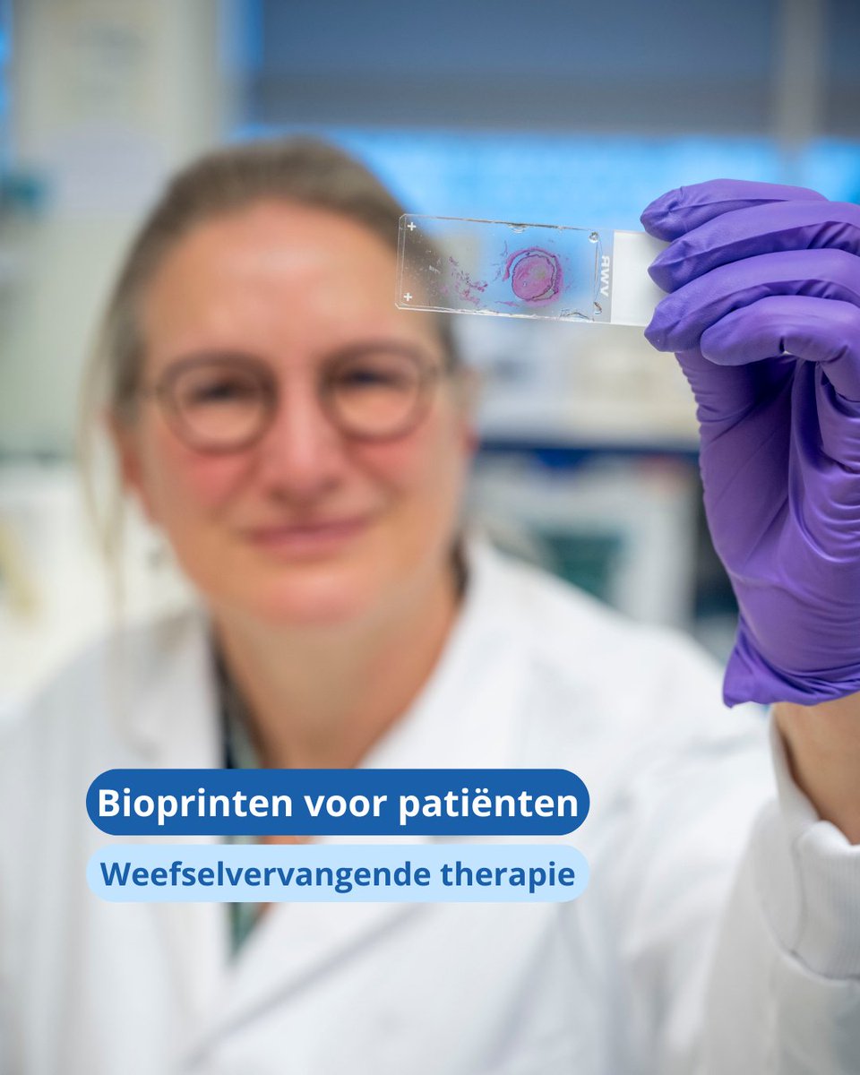 UMC Utrecht (@umcutrecht) on Twitter photo Bioprinten is een snel opkomende vorm van weefselvervangende therapie. De Europese Unie investeert daarom in 5 onderzoeksprojecten van <a href="/UMCUtrecht/">UMC Utrecht</a> en <a href="/UniUtrecht/">Utrecht University</a> om deze behandelingen beschikbaar te maken voor de patiënt➡️umcutrecht.nl/nl/over-ons/ni… Bioprinten is een snel opkomende vorm van weefselvervangende therapie. De Europese Unie investeert daarom in 5 onderzoeksprojecten van <a href="/UMCUtrecht/">UMC Utrecht</a> en <a href="/UniUtrecht/">Utrecht University</a> om deze behandelingen beschikbaar te maken voor de patiënt➡️umcutrecht.nl/nl/over-ons/ni…