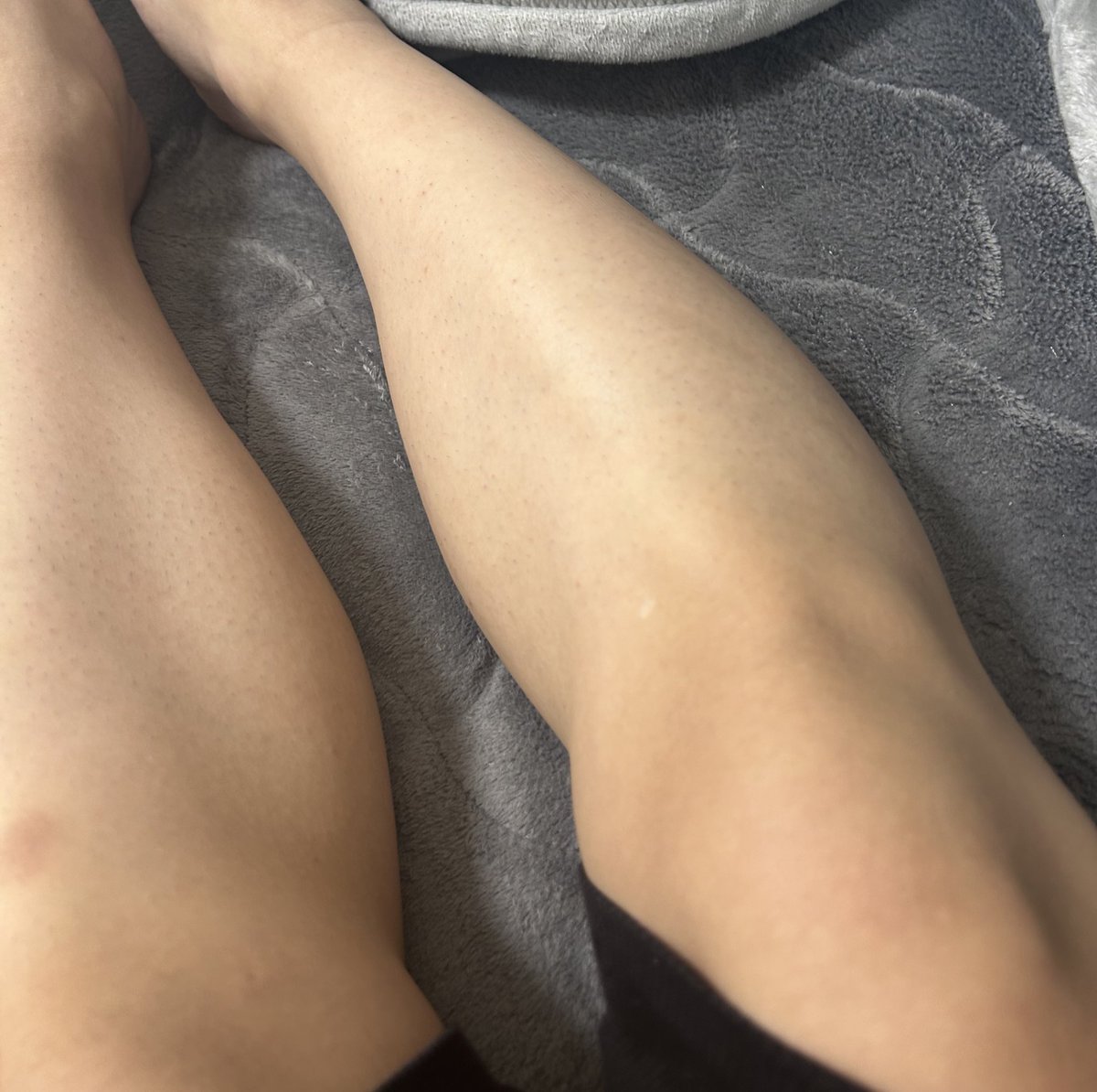 ちょい久しぶりに脱毛行ってきた！
ぬこさんありがとです！
<a href="/lapis_menssalon/">メンズサロン Lapis</a>