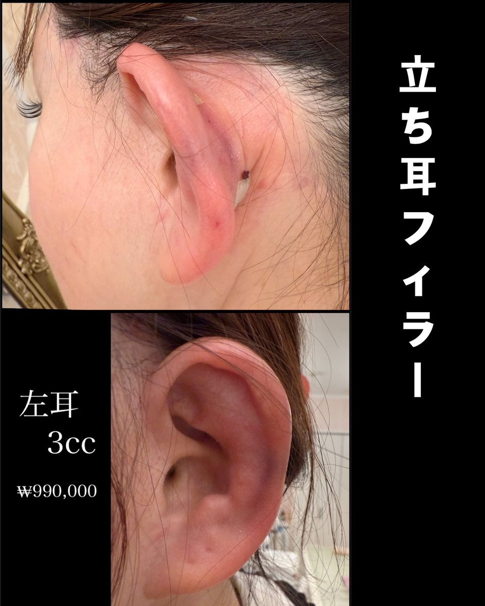 micax🐸整形垢 (@micax327) / Posts / X