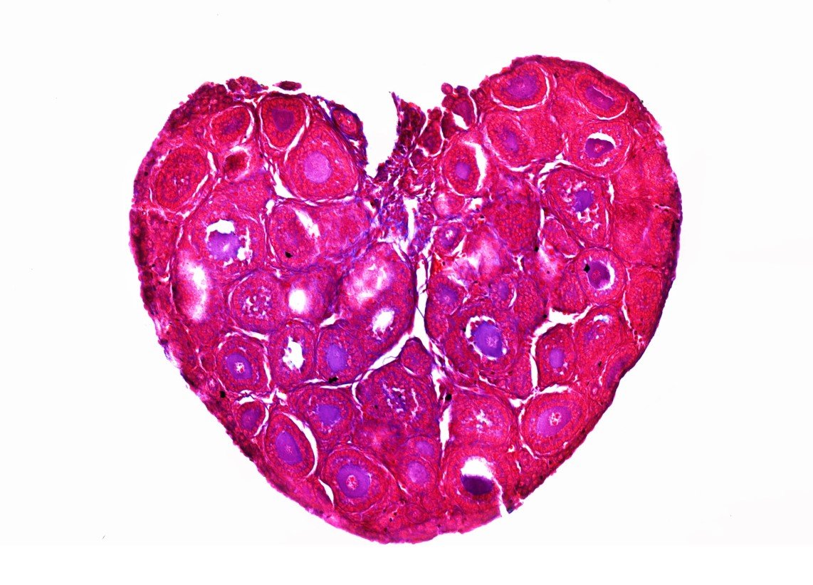 Third place in the faculty image competition for our Eva <a href="/evcakopecka/">Eva Kopecká</a> with the image of a rodent ovary full of follicles! A perfect cover for your next Valentine's card, just saying :)