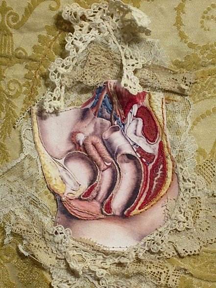 Hysteria I (2012) by US textile/visual artist Rachel Harmeyer #womensart