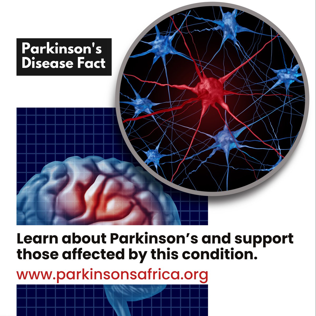 Parkinson’s is a progressive neurological condition that affects movement, coordination, and more. But did you know it’s caused by the loss of dopamine-producing brain cells? Understanding PD is the first step toward better support &amp; care.

Learn more: bit.ly/WhatIsPD

RT