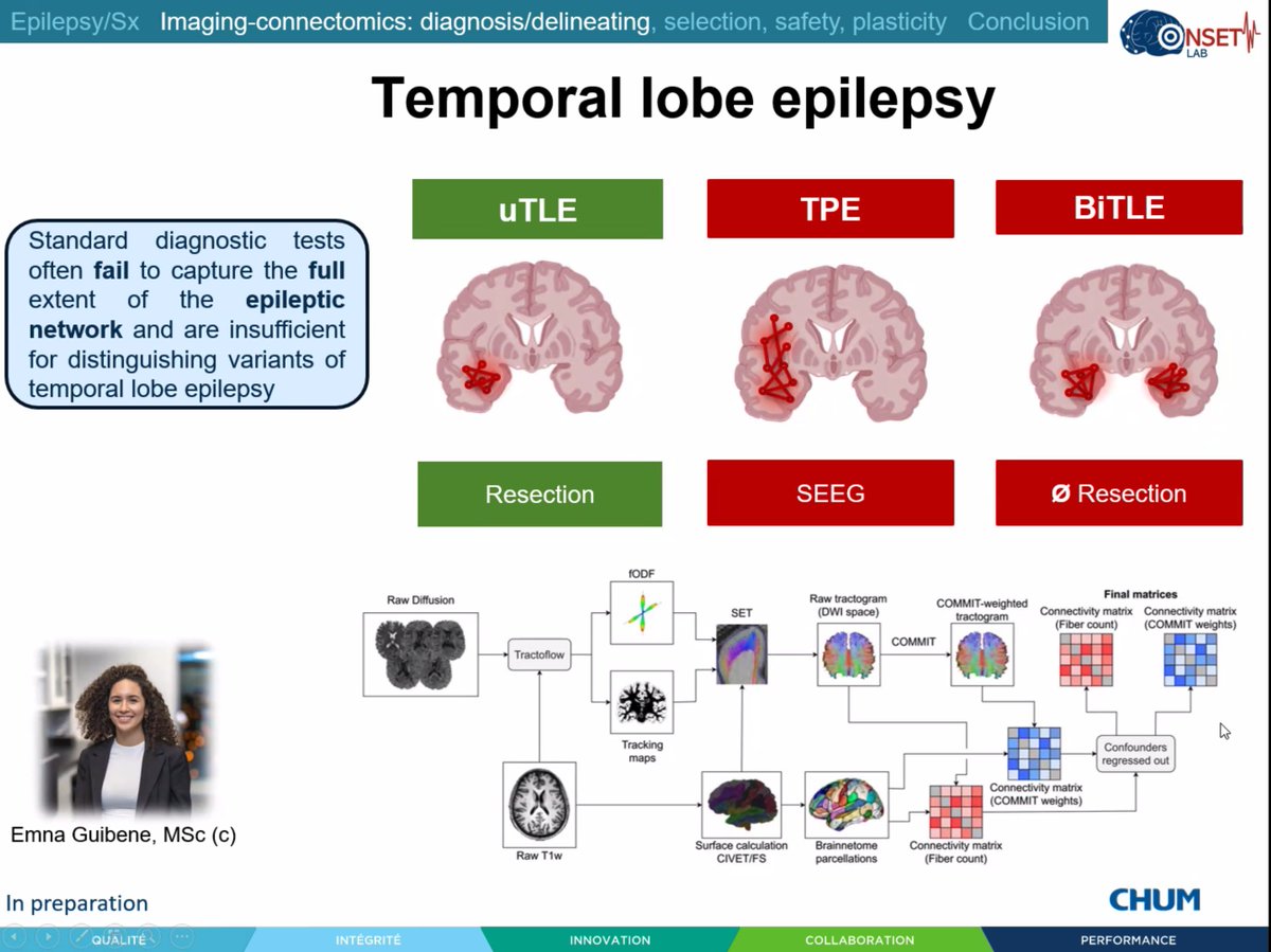 NEWepilepsy's tweet image. ✨ Highlight ✨ Epilepsy surgery isn’t just about a single region - it requires computational white matter network analysis and visualisation in surgery to optimise outcomes and prevent complications - Dr Sami Obaid zoom.us/j/95048511341
