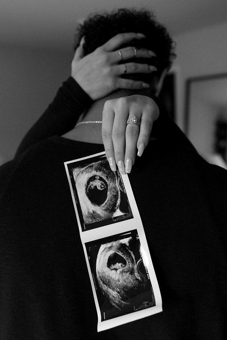 ؘ (@beijotatuado) on Twitter photo 