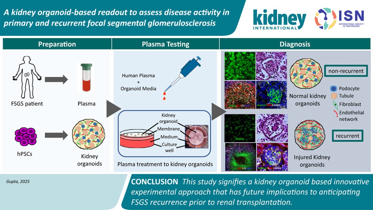 Kidney International (@kidney_int) on Twitter photo A kidney organoid-based readout to assess disease activity in primary and recurrent focal segmental glomerulosclerosis
doi.org/10.1016/j.kintā¦
#OpenAccess #FSGS #kidneyorganoid
<a href="/UAZMedTucson/">UA College of Medicine ā Tucson</a> <a href="/NUFeinbergMed/">Northwestern Feinberg School of Medicine</a> <a href="/utmbhealth/">UTMB Health</a> <a href="/NorthwesternBME/">Northwestern University - Biomedical Engineering</a> A kidney organoid-based readout to assess disease activity in primary and recurrent focal segmental glomerulosclerosis
doi.org/10.1016/j.kintā¦
#OpenAccess #FSGS #kidneyorganoid
<a href="/UAZMedTucson/">UA College of Medicine ā Tucson</a> <a href="/NUFeinbergMed/">Northwestern Feinberg School of Medicine</a> <a href="/utmbhealth/">UTMB Health</a> <a href="/NorthwesternBME/">Northwestern University - Biomedical Engineering</a>