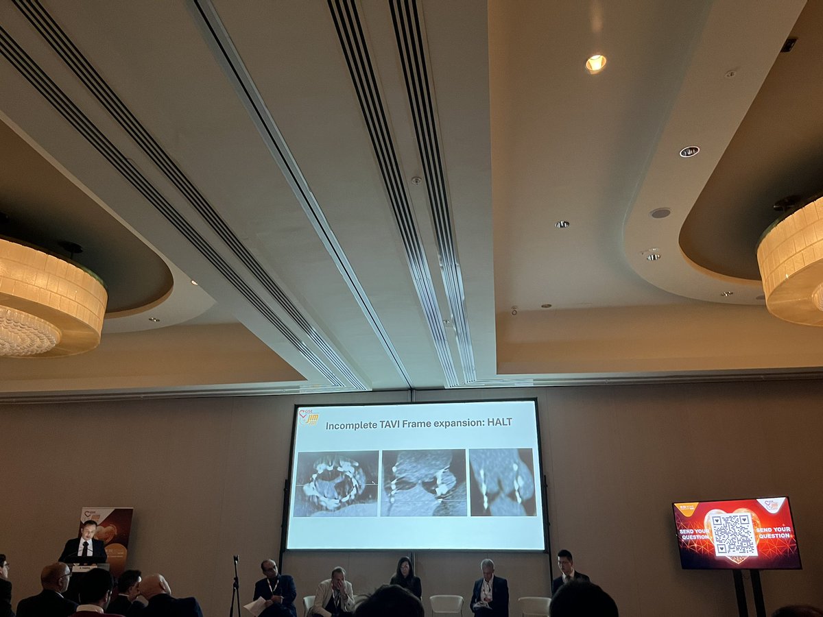 Chiara De Biase (@kiadeb87) on Twitter photo JIM GISE ROME 2025: evening symposium on TAVR controversies in Room Parallel 1. TAVI in BAV: a look ahead! <a href="/Sticchi_Alex/">Alessandro Sticchi</a> <a href="/CurioJonathan/">Jonathan Curio</a> <a href="/AliceBen_90/">Alice Benedetti</a> <a href="/parma/">Radoslaw Parma</a> #jimgise2025 JIM GISE ROME 2025: evening symposium on TAVR controversies in Room Parallel 1. TAVI in BAV: a look ahead! <a href="/Sticchi_Alex/">Alessandro Sticchi</a> <a href="/CurioJonathan/">Jonathan Curio</a> <a href="/AliceBen_90/">Alice Benedetti</a> <a href="/parma/">Radoslaw Parma</a> #jimgise2025