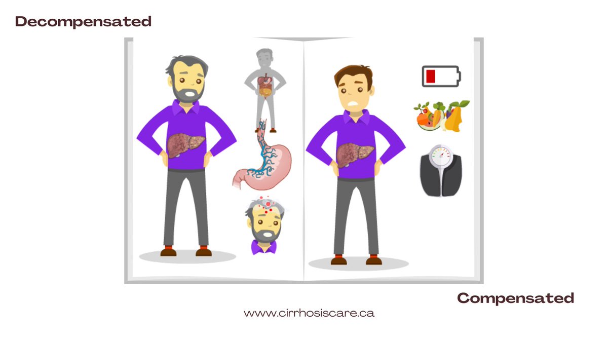 CirrhosisCareAB's tweet image. Help your patients understand the stages of cirrhosis. Direct them to CirrhosisCare.ca for clear information, printable resources, and educational videos. 🌟
1️⃣ Compensated Cirrhosis
2️⃣ Decompensated Cirrhosis
Support patient education with the right tools!
#LiverTwitter